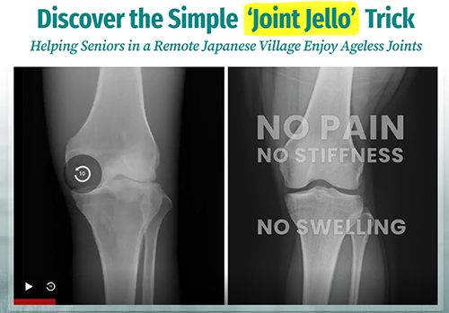 Joint Genesis; joint pain care